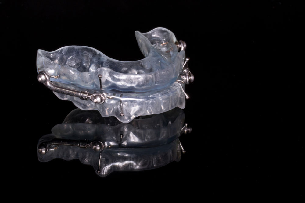 Side view of an orthodontic oral appliance