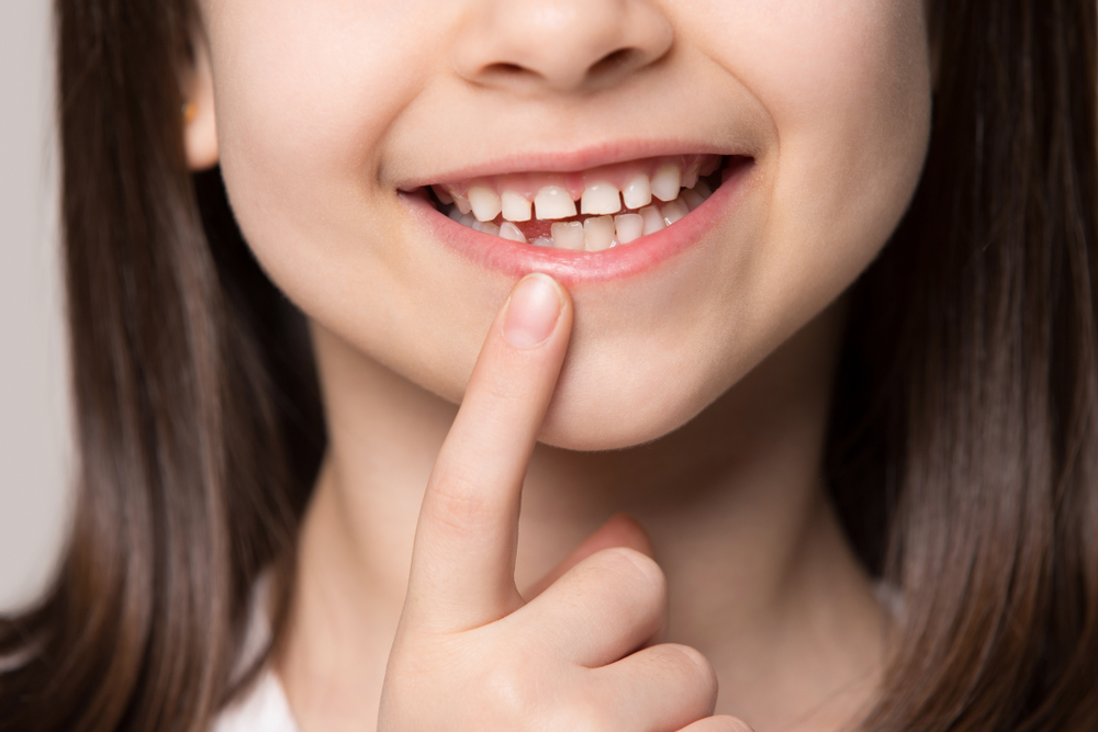 Is it safe to pull out a loose tooth?