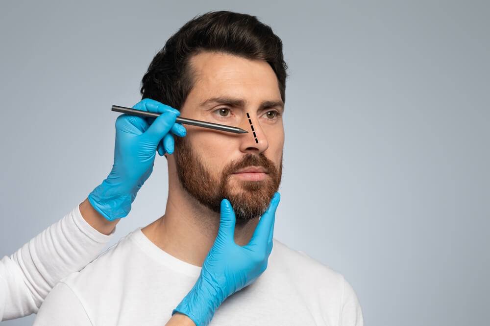 man getting nose job