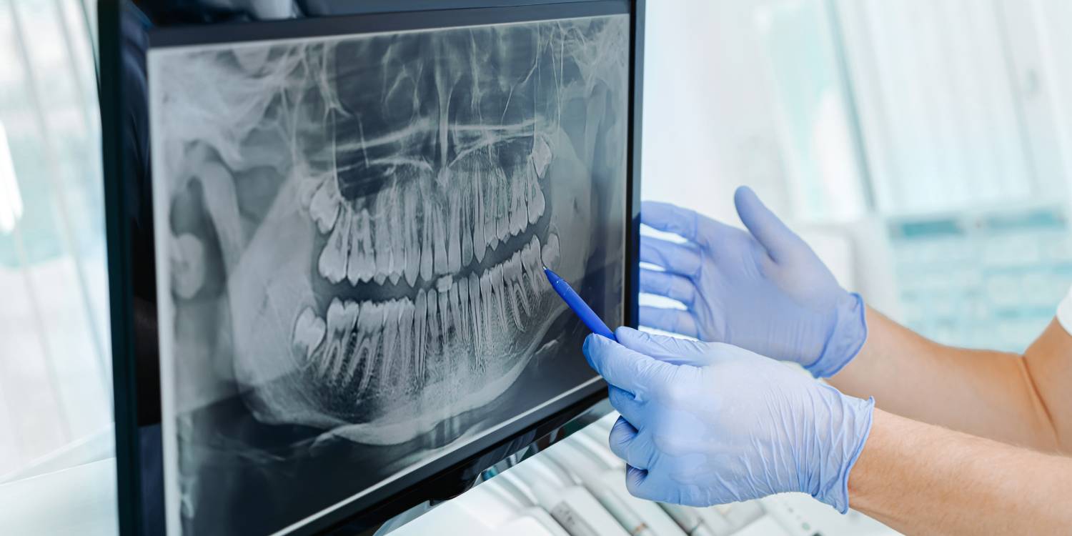 Dentist in gloves show the teeth on x-ray on digital screen