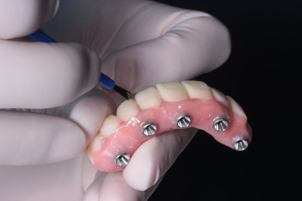 A dental technician painting and glazing an all on 4 implant retained full arch acrylic bridge