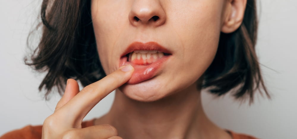 Cropped shot of a young woman showing red bleeding gums