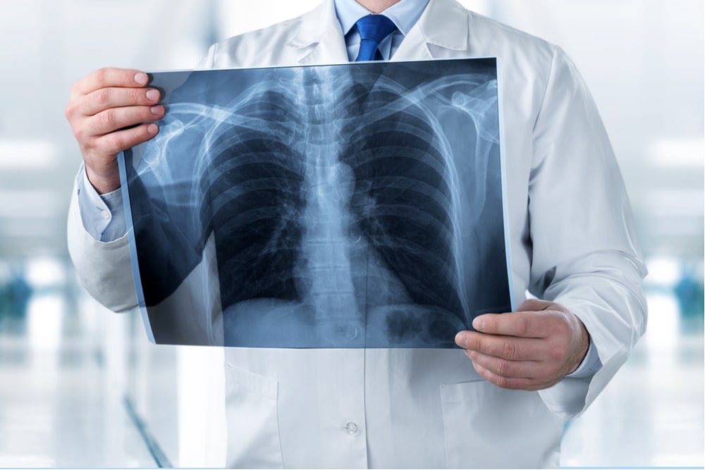 Doctor looking chest x-ray film in hospital