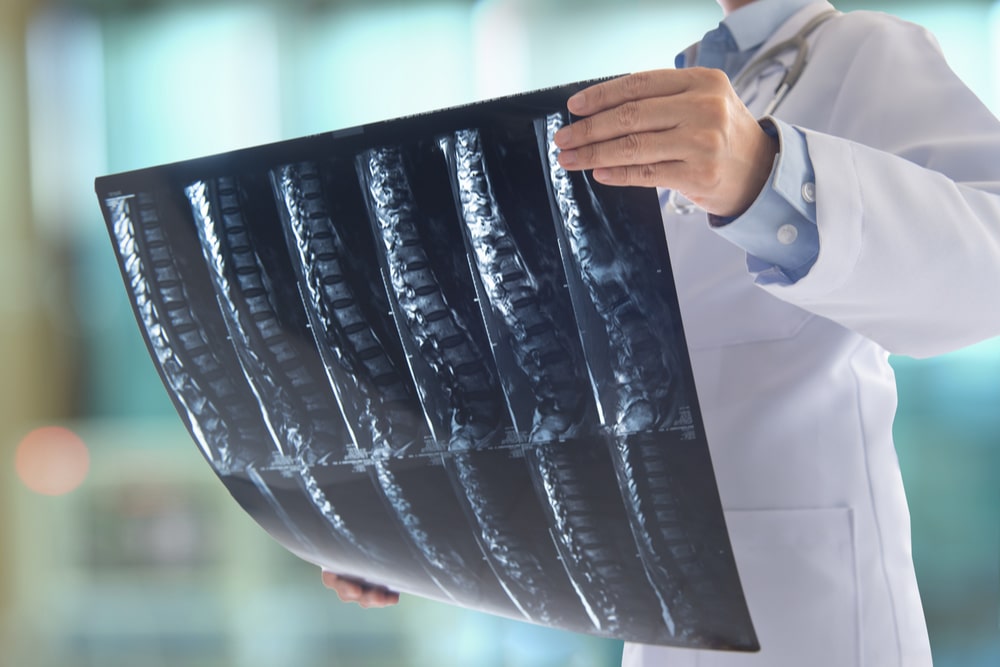 doctor surgeon look at spine x-ray film of patient at operating room.