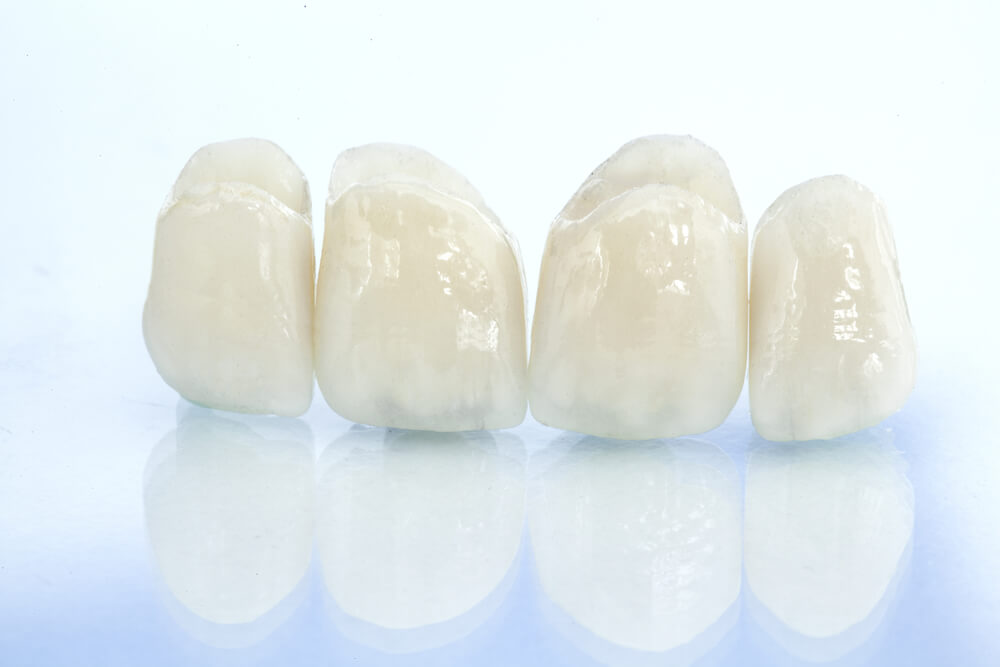 dental grown prosthetic on isolated background