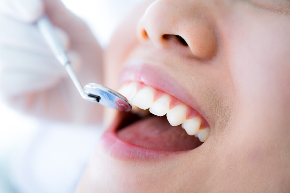 male getting a dental exam, instrument examining teeth